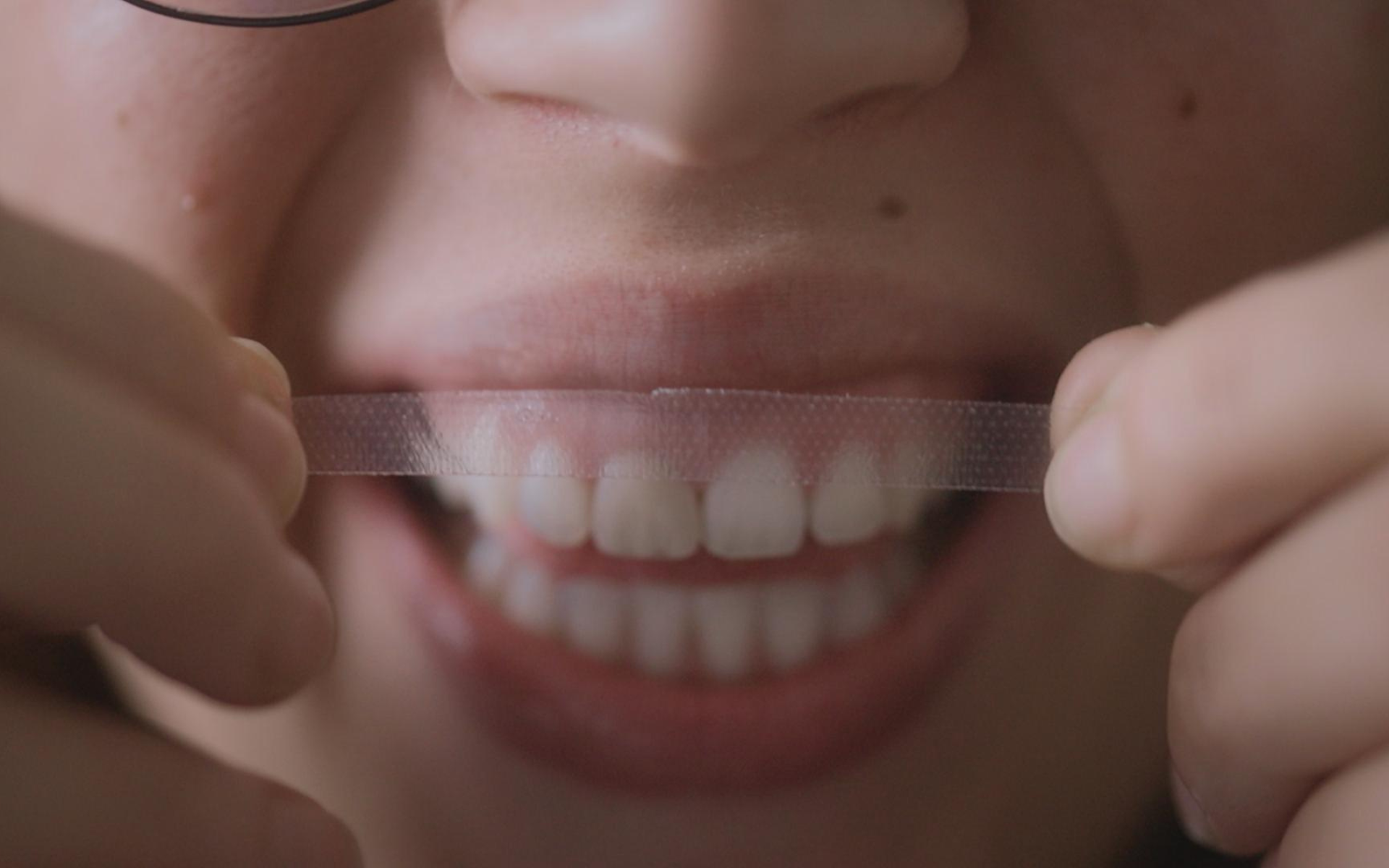 Des dents blanches au rire jaune